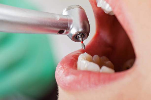 Best Emergency Dental Services for Seniors in Sublimity, OR